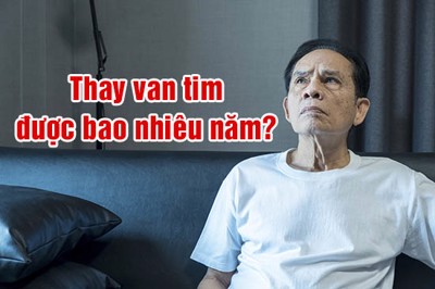 Thay van tim được bao nhiêu năm? – Cách “bảo quản” van tim lâu dài